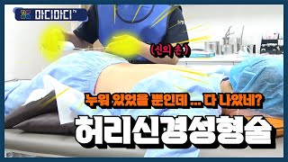 수면마취 허리 신경성형술 시술 방법