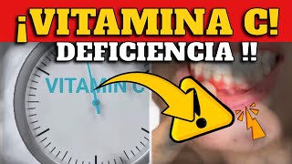 ¡CUIDADO! ¿FALTA DE VITAMINA C? - SEÑALES DE ALARMA !!!