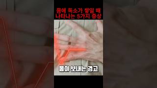 몸에 독이 쌓이면 나타나는 치명적인 신호 5가지!🚨 #건강관리  #건강정보 #건강