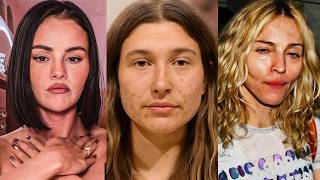 Celebrities Who Permanently RUINED Their Faces For Attention
