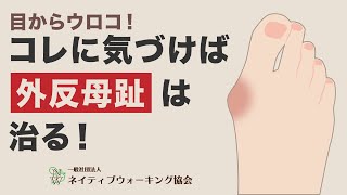 【足の専門家が教える】私たちはなぜ外反母趾を治せるようになったのか？　足病医学的に解説！