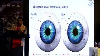 KSOS2022 Dr Ananth DoddaramegoudaD1 HD S4 T Treating inflammation in Dry Eye