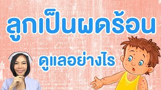 ผดร้อนในเด็ก เป็นแบบไหน แก้ให้หายแบบนี้