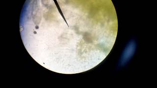 Lab Protozoa (Paramesium)