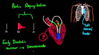 Systolic murmurs, diastolic murmurs, and extra heart sounds   Part 2