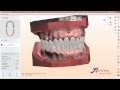 How to design Digital Full Dentures in 3Shape