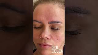 Kaş Silme İşlemi | Microblading | Microblading | Gül Çelen