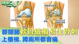 膝關節軟骨破損易生骨刺 上樓梯、蹲廁所都會痛 健康2.0