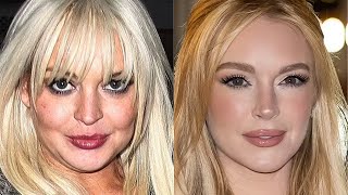 Lindsay Lohan Is Unrecognizable After $300K Face Lift