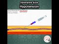 adrenaline epinephrine dose in hypotension pediatrics medicine epinephrine