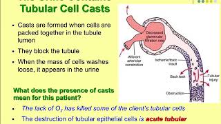 Pathophysiology Ch 28 Acute Kidney Injury and Chronic Kidney Disease