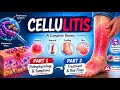 Cellulitis: What Every Healthcare Student Should Know