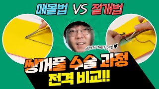 매몰법 vs 절개법, 에픽성형외과 쌍꺼풀 수술과정 전격 비교!