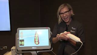 Scanning for a single-unit crown with the iTero Element™ 2 intraoral scanner