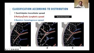 Female 63 years Malignant Melanoma metastatic deposits with Halo sign (English version)