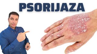 Najjači PRIRODNI LIJEKOVI za PSORIJAZU! Ovaj video  će promijeniti Vaš ŽIVOT...