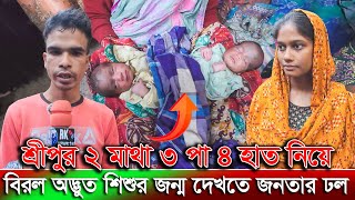 শ্রীপুর ২ মাথা ৩ পা ৪ হাত নিয়ে বিরল অদ্ভুত শিশুর জন্ম | দেখতে জনতার ঢল | Sripur | rk news24