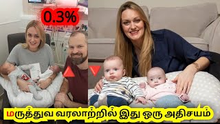 😱 மருத்துவ வரலாற்றில் நடந்த வினோத சம்பவம் 👇 || இது கட்டாயம் ஒரு ஆச்சரியமே || History || Science ||