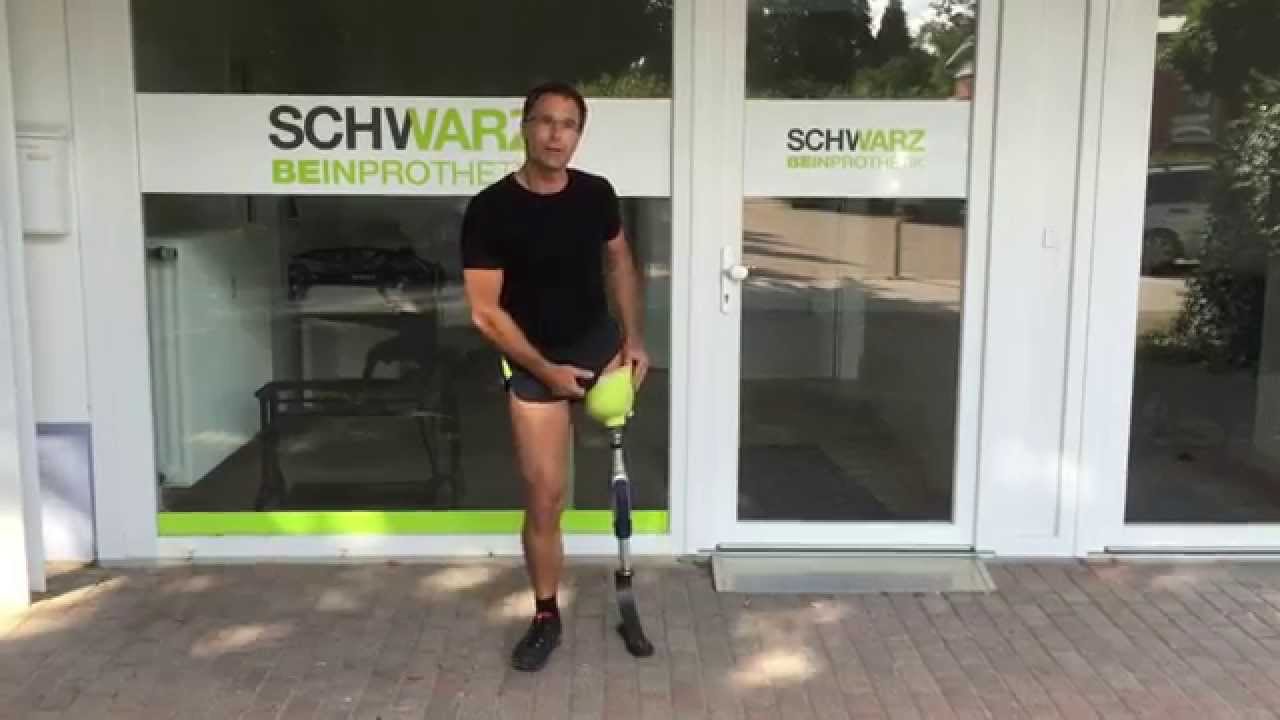 Above Knee Amputee Prosthetic Socket Fit - YouTube