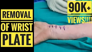 Removal of Volar Wrist Plate