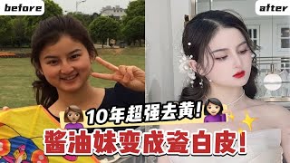 【10年超强去黄！酱油妹逆袭瓷白皮】全程干货，10年美白大法~ 赶走暗黄！让你白成灯泡肌！