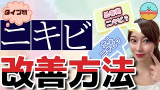 【ニキビ改善】種類別ニキビの原因と対策