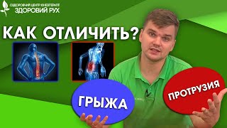 Грыжа или протрузия, как отличить? Нужна ли операция? | КИНЕЗИТЕРАПИЯ