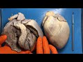 heart dissection