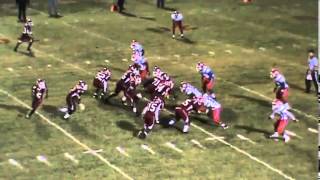 Flexbone: Midline Option
