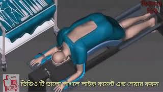 চিকিৎসা  ক্ষেত্রে বিজ্ঞান দেখে আমি তো অবাক। I am surprised to see science in the medical field