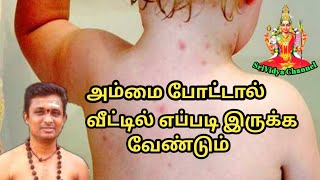 அம்மை போட்டால் வீட்டில் எப்படி இருக்க வேண்டும்?