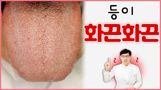 배열증/ 등이 뜨끈뜨끈한 이유