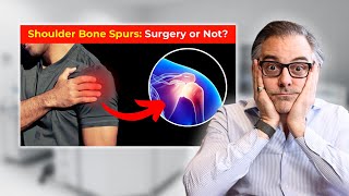 Shoulder Bone Spurs: Causes, Treatments \u0026 When to See a Doctor | @PeterDeNobleMD Explains