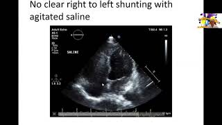 Rare form of Atrial Septal Defects and Review of ASDs