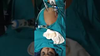 Laparoscopic cholecystectomy Surgery #shorts #viral #youtubeshorts  #ytshorts