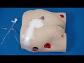 Bridging to Offload FitPad - Medela Invia® Gauze Dressing Application