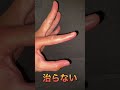 shorts 今日の一句…テーマ『脱臼』