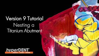 hyperDENT V9 Tutorial: Nesting a Titanium Abutment