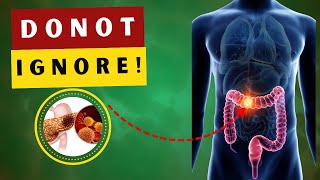 7 Early Warning Signs of Colon Cancer You Must Not Ignore [Warning] ⚠️