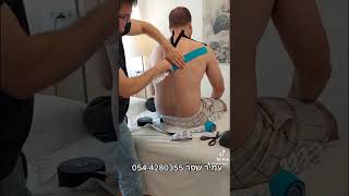 קינזיוטייפינג לכאב צוואר מקרין ליד | kinesiotaping for radiating neck pain