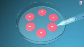 IVF: What Are Test Tube Babies? In Vitro Fertilisation Treatment Explained