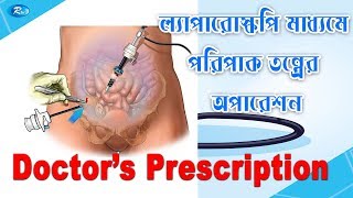 Doctors Prescription | ল্যাপারোস্কপি মাধ্যমে পরিপাক তন্ত্রের অপারেশন | Ep- 26 | Rtv Health Program