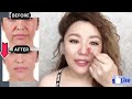 🛑 age 40 face lifting exercises for jowls and saggy skin laugh lines forehead frown line