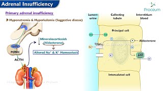 Adrenal Insufficiency (Internal medicine) | Endocrinology Lecture