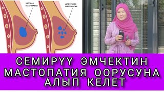 Баланы эрте эмчектен чыгарбаныз, мастопатияга кабыласыз