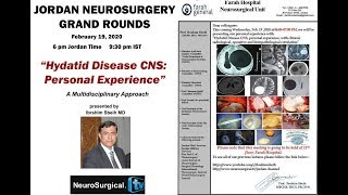 Hydatid Disease CNS  Personal Experience