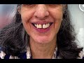 Can I fix invisible braces during adult life or at older age - Advantage