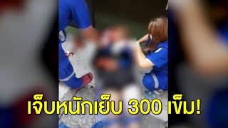 สาวถูกสามีโหดกรีดแขนขาเหวอะ - กรรไกรแทงเจ็บหนัก เย็บกว่า 300 เข็ม