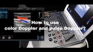 How to use color Doppler and pulse Doppler on ultrasound？