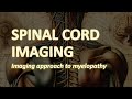 Spinal Cord Imaging: Imaging approach to Myelopathy